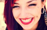 A Newbie’s Guide to Dermal Implants
