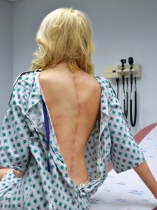 Victoria Graham Is Turning Invisible Illness into Public Awareness