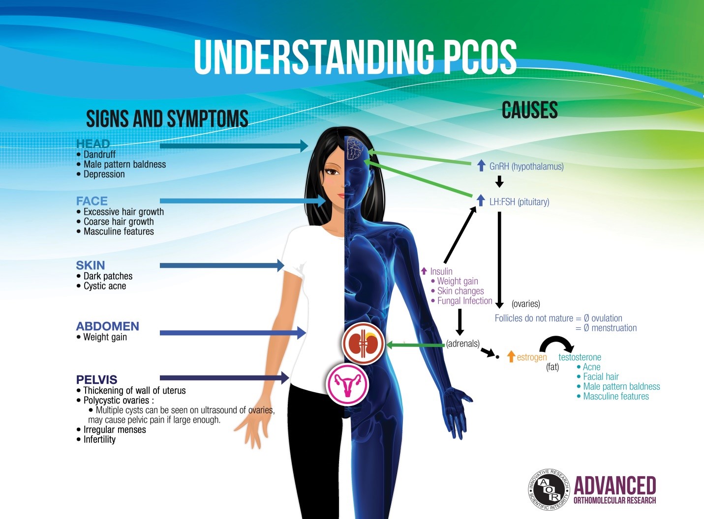 PCOS Study Breaks