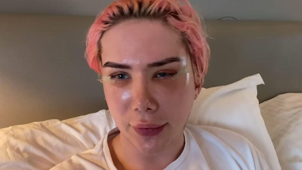 In an article about cultural appropriation and fetishization, Oli London sits in bed recovering from plastic surgery to slant their eyes.