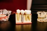 in article about oral health behaviors, models of teeth