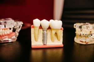 in article about oral health behaviors, models of teeth